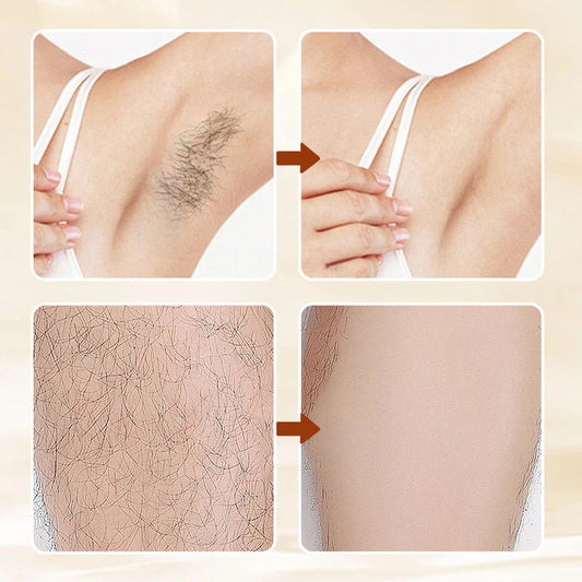 🔥Limited Time Promotion 50% OFF✨Versatile Aromatic  Hair Removal Cream